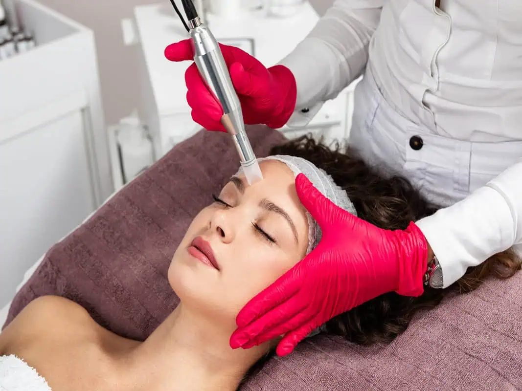 Microneedling by saltaestheticsbar in WILMINGTON, NC