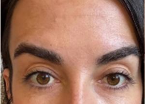 moxi after results in Wilmington NC