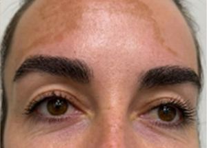 moxi before results in Wilmington NC